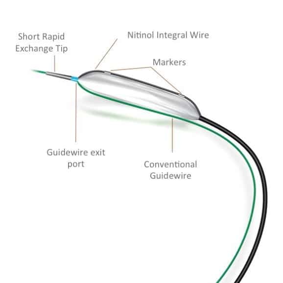 ORBUS NEICH SCORFLEX NC SCORING BALLOON (ALL SIZE AVAILABLE) - ONA ...